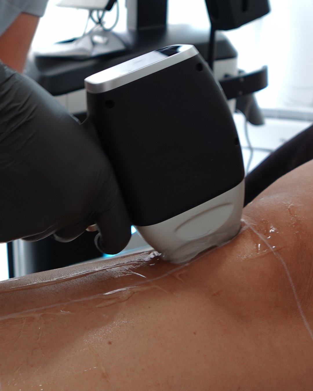 Depilación láser en Tôme Clinic