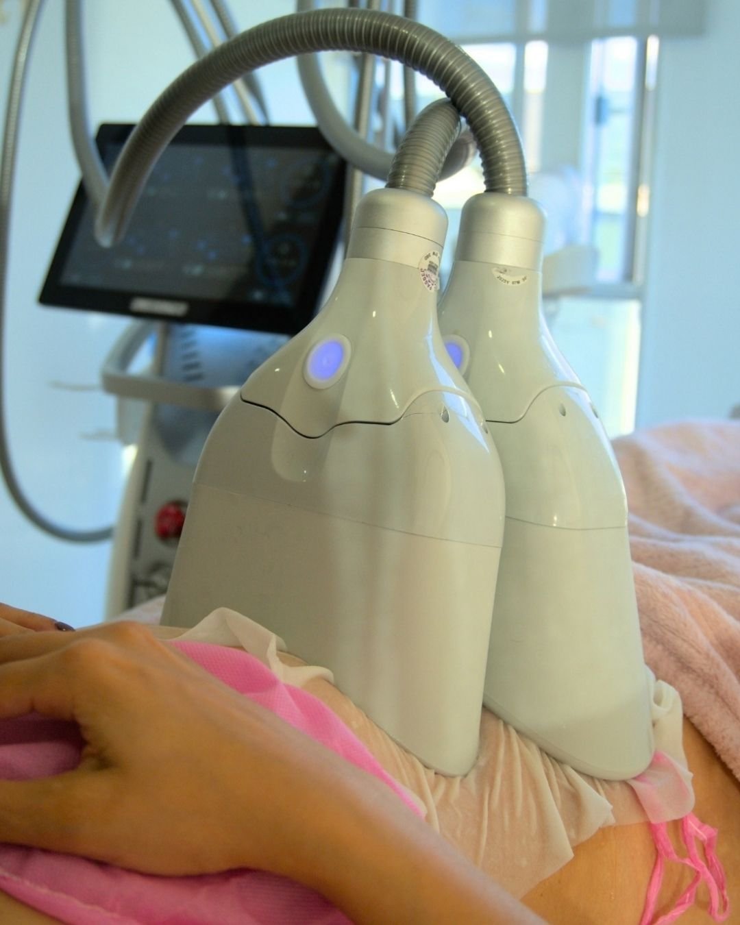 Criolipólisis Cryonic Pro en Tôme Clinic